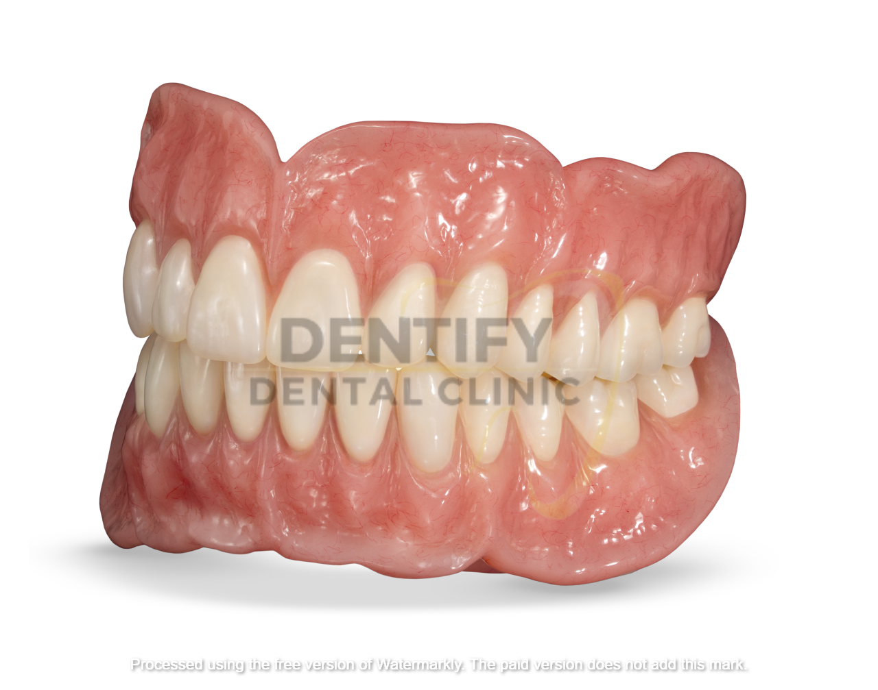 Root canal treatment at Dentify Dental Clinic, best dental clinic in Delhi