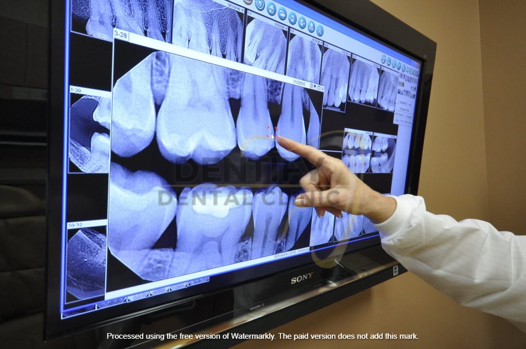 Digital Xray at Dentify Dental Clinic, best dental clinic in Delhi